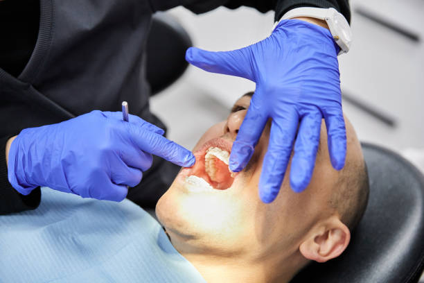 Urgent Tooth Repair in LA