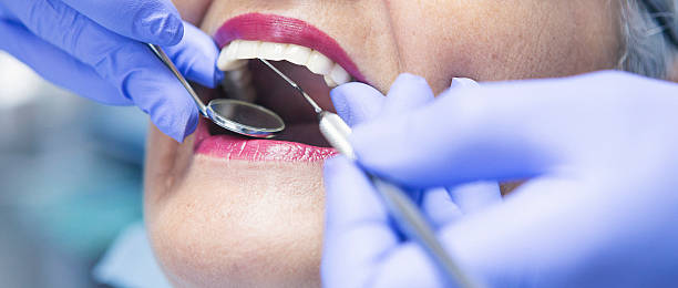 Best Dentist for Tooth Abscess  in Franklin, LA